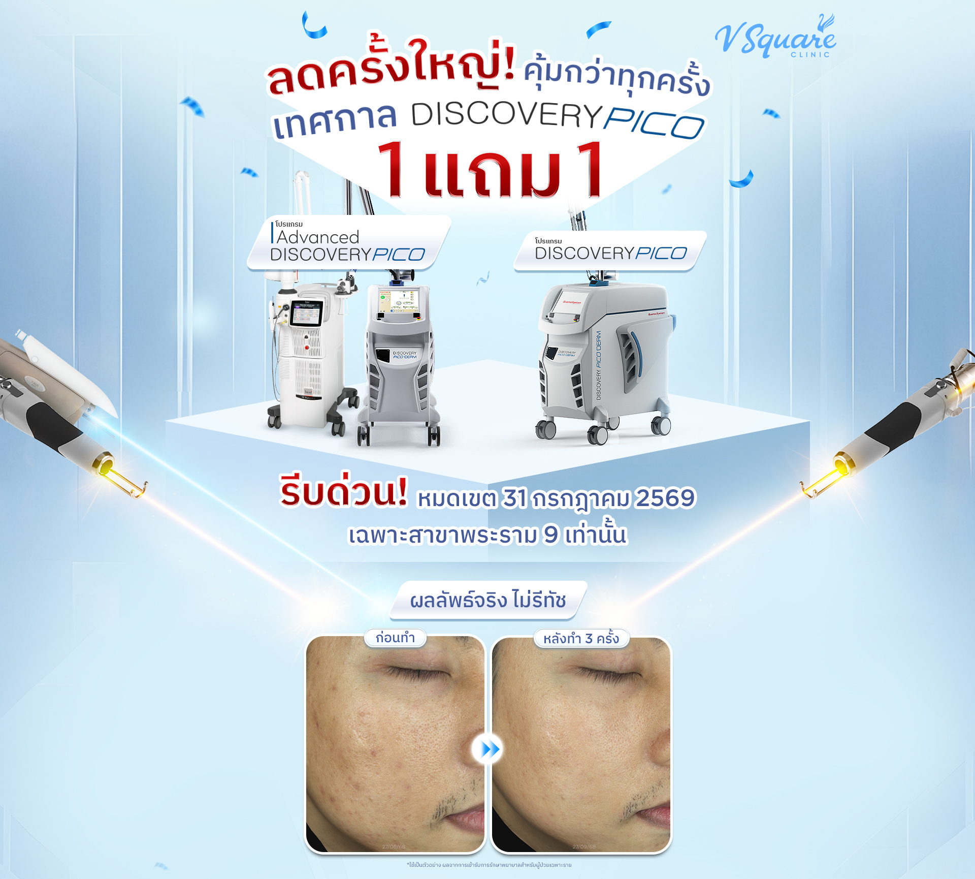 ลดครั้งใหญ่! คุ้มกว่าทุกครั้ง เทศกาล DISCOVERY PICO 1 แถม 1