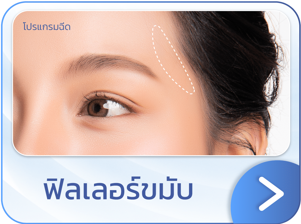 ฟิลเลอร์ขมับ แบนเนอร์