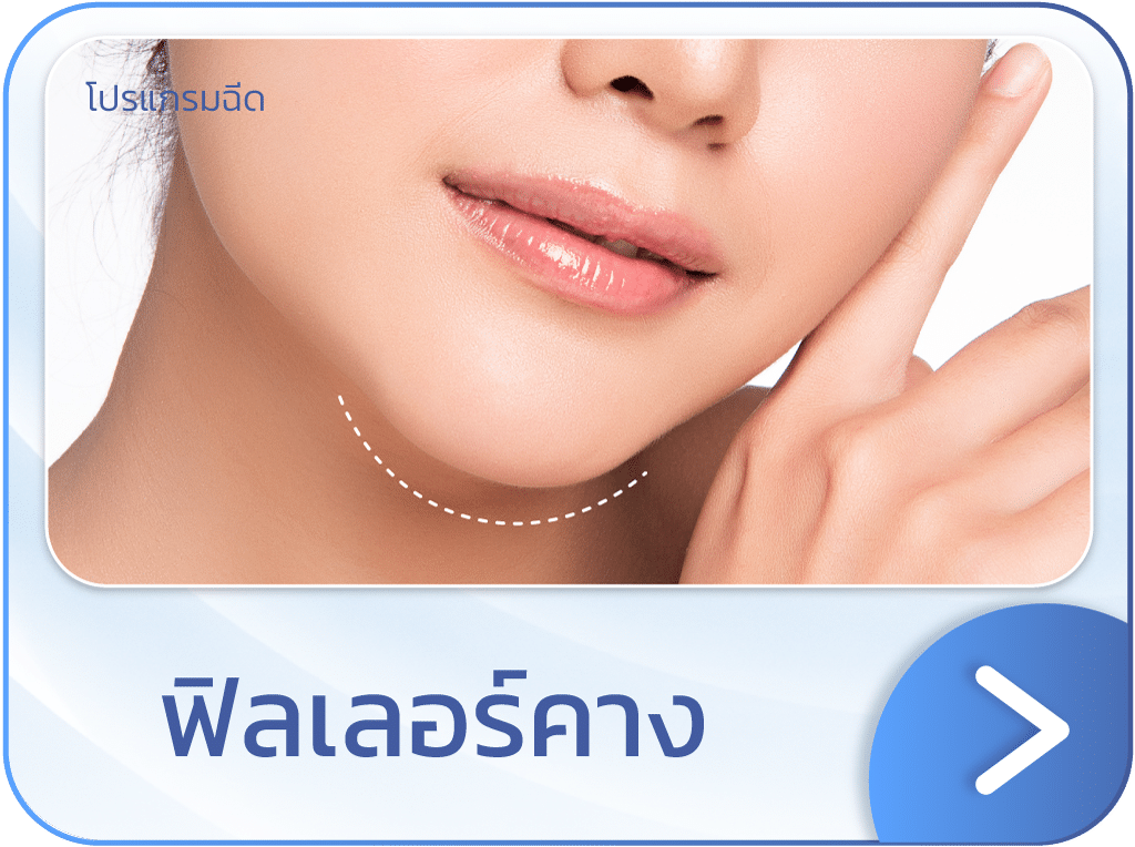 ฟิลเลอร์คาง แบนเนอร์
